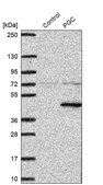 Anti-PGC antibody produced in rabbit Prestige Antibodies&#174; Powered by Atlas Antibodies, affinity isolated antibody, buffered aqueous glycerol solution