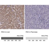 Anti-PAH antibody produced in rabbit Prestige Antibodies&#174; Powered by Atlas Antibodies, affinity isolated antibody, buffered aqueous glycerol solution