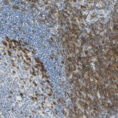 Anti-LAT antibody produced in rabbit Prestige Antibodies&#174; Powered by Atlas Antibodies, affinity isolated antibody, buffered aqueous glycerol solution