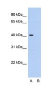 Anti-PCBP1 antibody produced in rabbit IgG fraction of antiserum