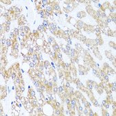 Anti-CHD1 antibody produced in rabbit