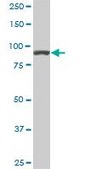 Monoclonal Anti-ACTN4 antibody produced in mouse clone 4D10, ascites fluid