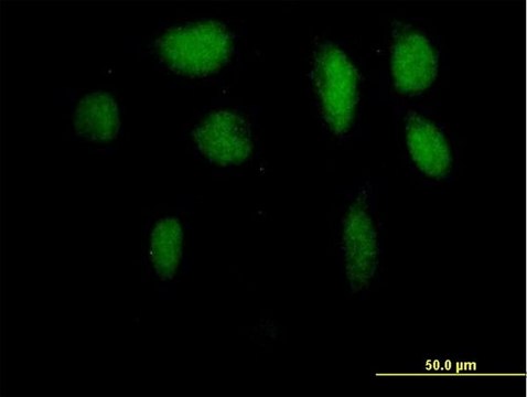 Anti-ZKSCAN5 antibody produced in mouse purified immunoglobulin, buffered aqueous solution