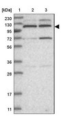 Anti-KIF4A antibody produced in rabbit Prestige Antibodies&#174; Powered by Atlas Antibodies, affinity isolated antibody, buffered aqueous glycerol solution