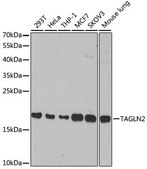 Anti-TAGLN2 antibody produced in rabbit