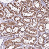 Anti-ALG8 antibody produced in rabbit Prestige Antibodies&#174; Powered by Atlas Antibodies, affinity isolated antibody, buffered aqueous glycerol solution