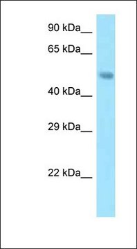 Anti-SNX5 antibody produced in rabbit affinity isolated antibody