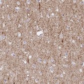 Anti-SLC6A1 antibody produced in rabbit Prestige Antibodies&#174; Powered by Atlas Antibodies, affinity isolated antibody, buffered aqueous glycerol solution