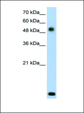 Anti-RSAD2 (AB1) antibody produced in rabbit IgG fraction of antiserum