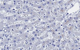 Anti-GCLM Antibody, clone 1D19 ZooMAb&#174; Rabbit Monoclonal recombinant, expressed in HEK 293 cells