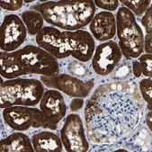 Anti-ACO1 antibody produced in rabbit Prestige Antibodies&#174; Powered by Atlas Antibodies, affinity isolated antibody, buffered aqueous glycerol solution, Ab1