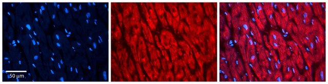 Anti-RAD23B antibody produced in rabbit affinity isolated antibody