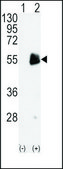 Anti-PRMT7 (C-term) antibody produced in rabbit saturated ammonium sulfate (SAS) precipitated, buffered aqueous solution