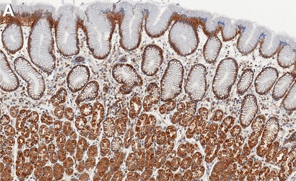 Anti-ARF6 Antibody, clone 1C10 ZooMAb&#174; Rabbit Monoclonal recombinant, expressed in HEK 293 cells