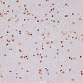 Anti-Acetyl-Histone H3-K9/K14/K18/K23/K27 antibody produced in rabbit