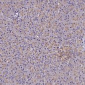Anti-CYP2D6 antibody produced in rabbit Prestige Antibodies&#174; Powered by Atlas Antibodies, affinity isolated antibody, buffered aqueous glycerol solution