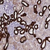 Anti-HSD11B2 antibody produced in rabbit Prestige Antibodies&#174; Powered by Atlas Antibodies, affinity isolated antibody, buffered aqueous glycerol solution