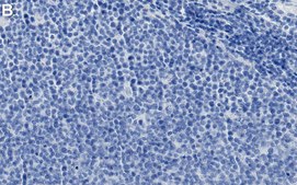 Anti-TGFBR2 Antibody, clone 1N11 ZooMAb&#174; Rabbit Monoclonal recombinant, expressed in HEK 293 cells