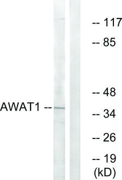 Anti-AWAT1 antibody produced in rabbit affinity isolated antibody