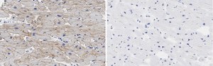 Anti-Laminin &#945;2 Antibody, clone 2I22 ZooMAb&#174; Rabbit Monoclonal recombinant, expressed in HEK 293 cells