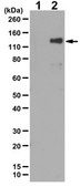 Anti-phospho TIE2/TEK Antibody (Tyr992) 0.25&#160;mg/mL, from rabbit