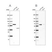 Anti-ZC3HC1 antibody produced in rabbit Prestige Antibodies&#174; Powered by Atlas Antibodies, affinity isolated antibody, buffered aqueous glycerol solution