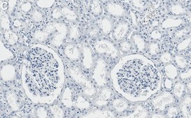 Anti-PKR Antibody, clone 2H14 ZooMAb&#174; Rabbit Monoclonal recombinant, expressed in HEK 293 cells