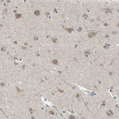 Anti-NFKBIE antibody produced in rabbit Ab2, Prestige Antibodies&#174; Powered by Atlas Antibodies, affinity isolated antibody, buffered aqueous glycerol solution
