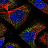 Anti-CNOT6 antibody produced in rabbit Prestige Antibodies&#174; Powered by Atlas Antibodies, affinity isolated antibody, buffered aqueous glycerol solution