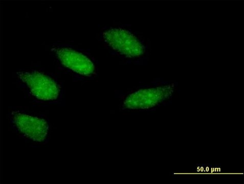 Anti-EGR2 antibody produced in mouse purified immunoglobulin, buffered aqueous solution