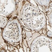 Anti-NGFR antibody produced in rabbit Prestige Antibodies&#174; Powered by Atlas Antibodies, affinity isolated antibody, buffered aqueous glycerol solution