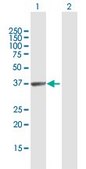 Anti-HABP4 antibody produced in rabbit purified immunoglobulin, buffered aqueous solution