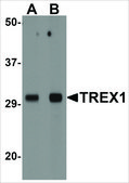 Anti-TREX1 antibody produced in rabbit affinity isolated antibody, buffered aqueous solution