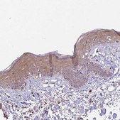 Anti-DSP antibody produced in rabbit Prestige Antibodies&#174; Powered by Atlas Antibodies, affinity isolated antibody, buffered aqueous glycerol solution