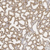 Anti-LALBA antibody produced in rabbit Prestige Antibodies&#174; Powered by Atlas Antibodies, affinity isolated antibody, buffered aqueous glycerol solution