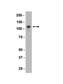 Anti-P-Cadherin Antibody, clone 6A9 ascites fluid, clone 6A9, Upstate&#174;