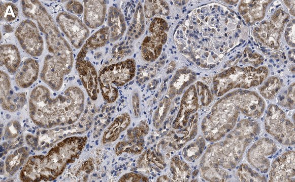 Anti-TCF25 Antibody, clone 1B14 ZooMAb&#174; Rabbit Monoclonal recombinant, expressed in HEK 293 cells