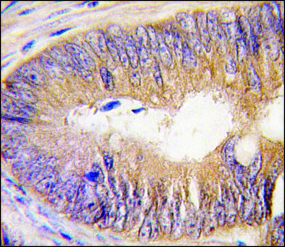 Anti-TASP1 N-term antibody produced in rabbit IgG fraction of antiserum, buffered aqueous solution