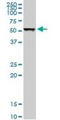 Anti-TUBB1 antibody produced in rabbit purified immunoglobulin, buffered aqueous solution