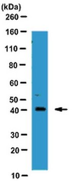 Anti-Tristetraprolin Antibody from rabbit, purified by affinity chromatography