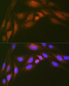 Anti-Ube2N/Ubc13 antibody produced in rabbit