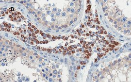 Anti-OCT4 Antibody, clone 4N8, ZooMAb&#174; Rabbit Monoclonal recombinant, expressed in HEK 293 cells