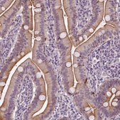Anti-C6orf106 antibody produced in rabbit Prestige Antibodies&#174; Powered by Atlas Antibodies, affinity isolated antibody, buffered aqueous glycerol solution