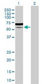 Anti-PIK3R5 antibody produced in rabbit purified immunoglobulin, buffered aqueous solution