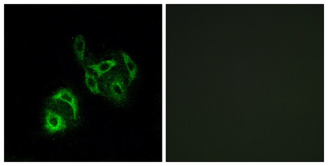 Anti-SLC27A4 antibody produced in rabbit affinity isolated antibody