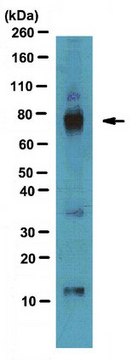 Anti-AKAP 79 Antibody from rabbit, purified by affinity chromatography