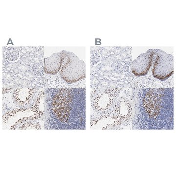 Anti-NCAPH antibody produced in rabbit Prestige Antibodies&#174; Powered by Atlas Antibodies, affinity isolated antibody, buffered aqueous glycerol solution