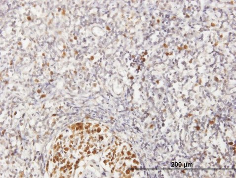 Anti-MCM6 antibody produced in mouse purified immunoglobulin, buffered aqueous solution