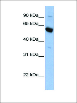 Anti-SLC45A3 antibody produced in rabbit affinity isolated antibody