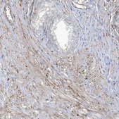Anti-CACNB2 antibody produced in rabbit Prestige Antibodies&#174; Powered by Atlas Antibodies, affinity isolated antibody, buffered aqueous glycerol solution